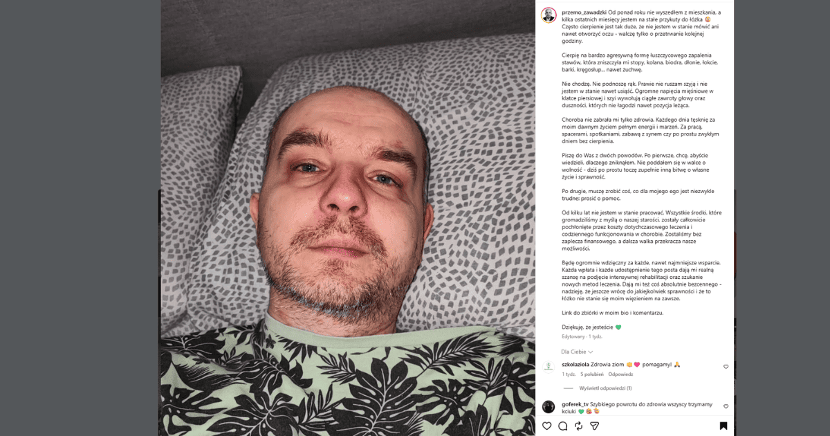 ruszyła zbiórka dla Przemka Zawadzkiego